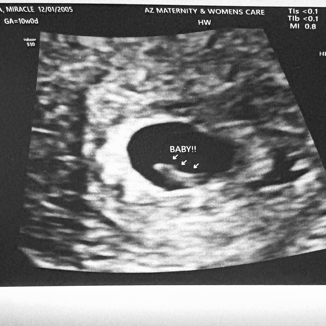 Photo shared by Miracle for their Babylist baby registry.