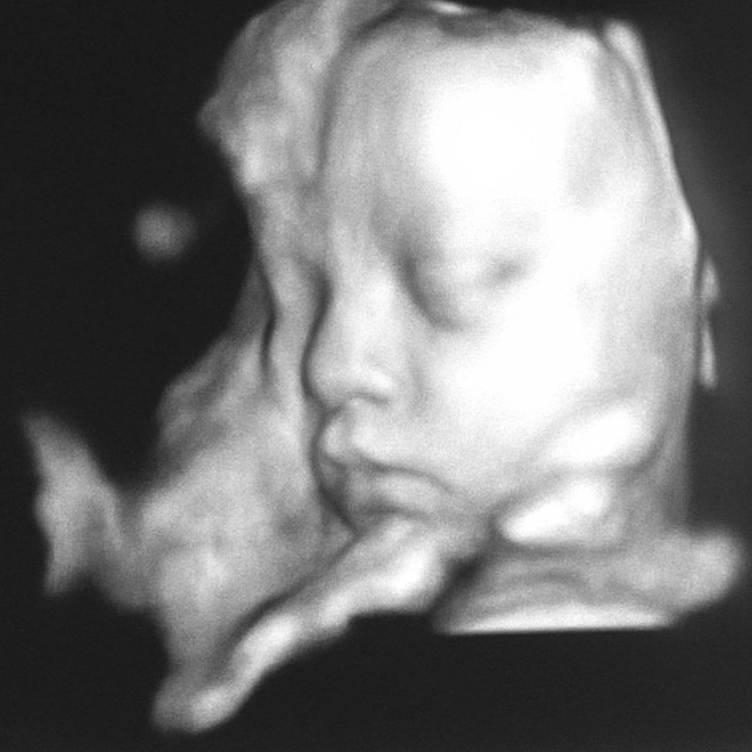Photo shared by Jaydn for their Babylist baby registry.