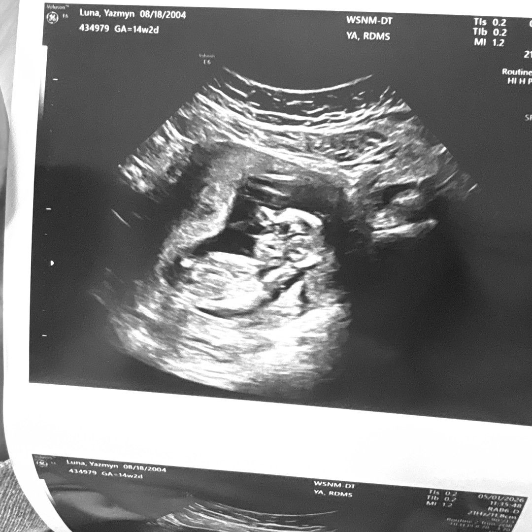 Photo shared by Yazmyn for their Babylist baby registry.