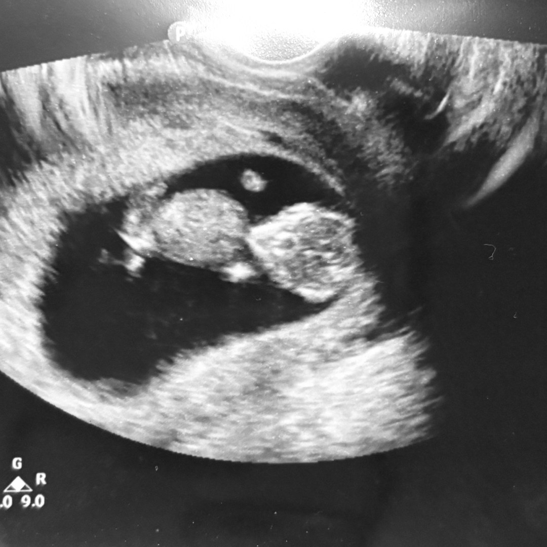 Photo shared by Tiffany for their Babylist baby registry.