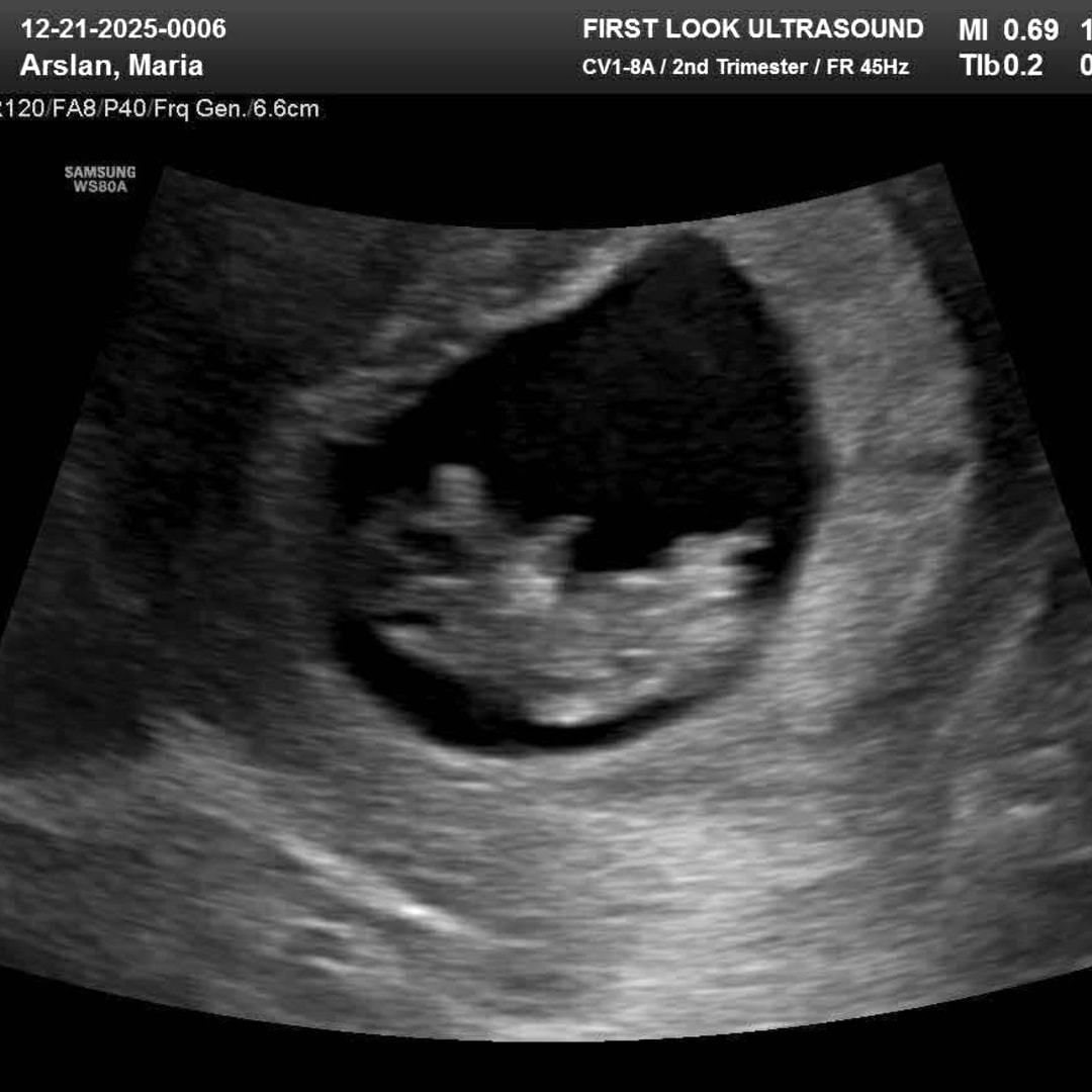 Photo shared by Maria for their Babylist baby registry.