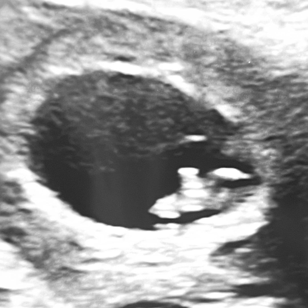 Photo shared by Lacy for their Babylist baby registry.