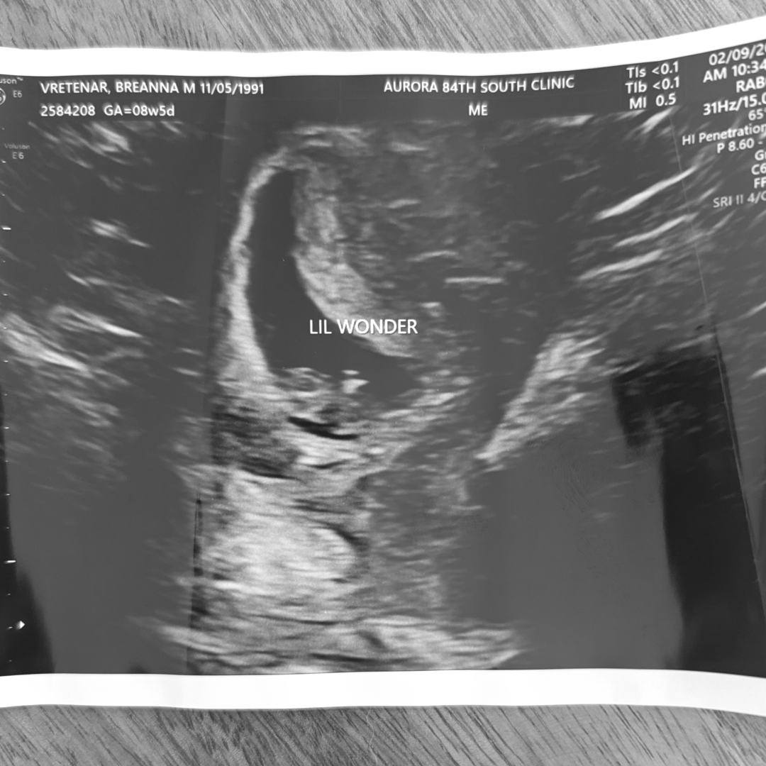 Photo shared by Breanna for their Babylist baby registry.