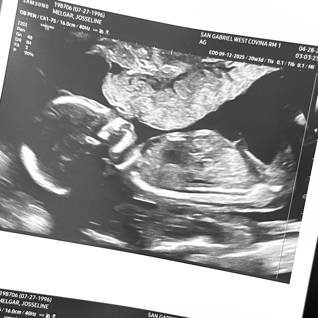 Photo shared by Josseline for their Babylist baby registry.