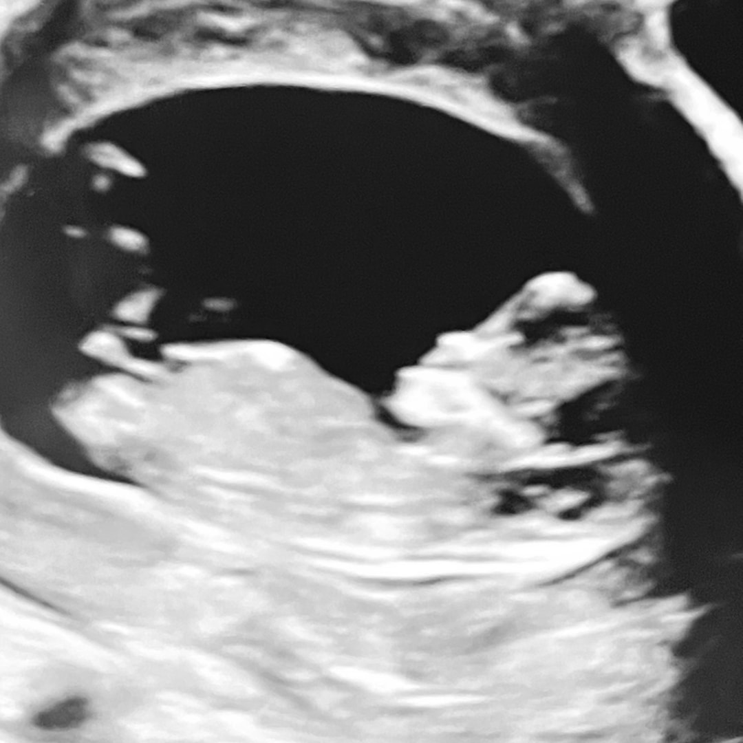 Photo shared by Ashley for their Babylist baby registry.