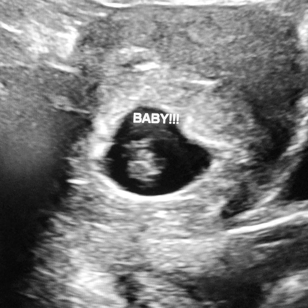 Photo shared by Katelyn for their Babylist baby registry.