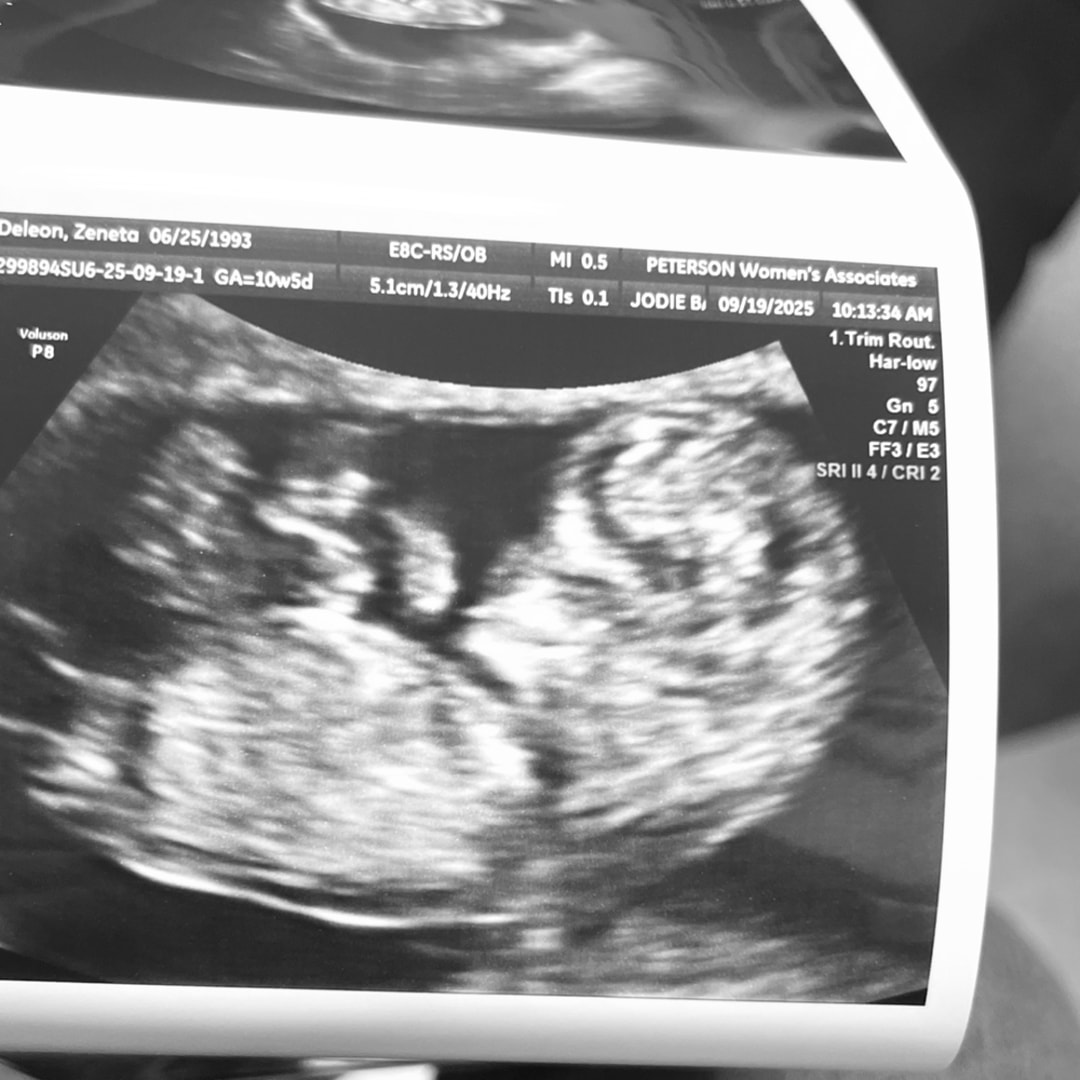 Photo shared by Zeneta for their Babylist baby registry.