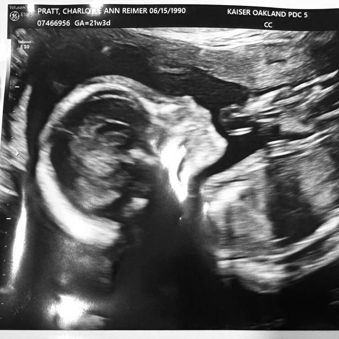 Photo shared by Charlotte for their Babylist baby registry.