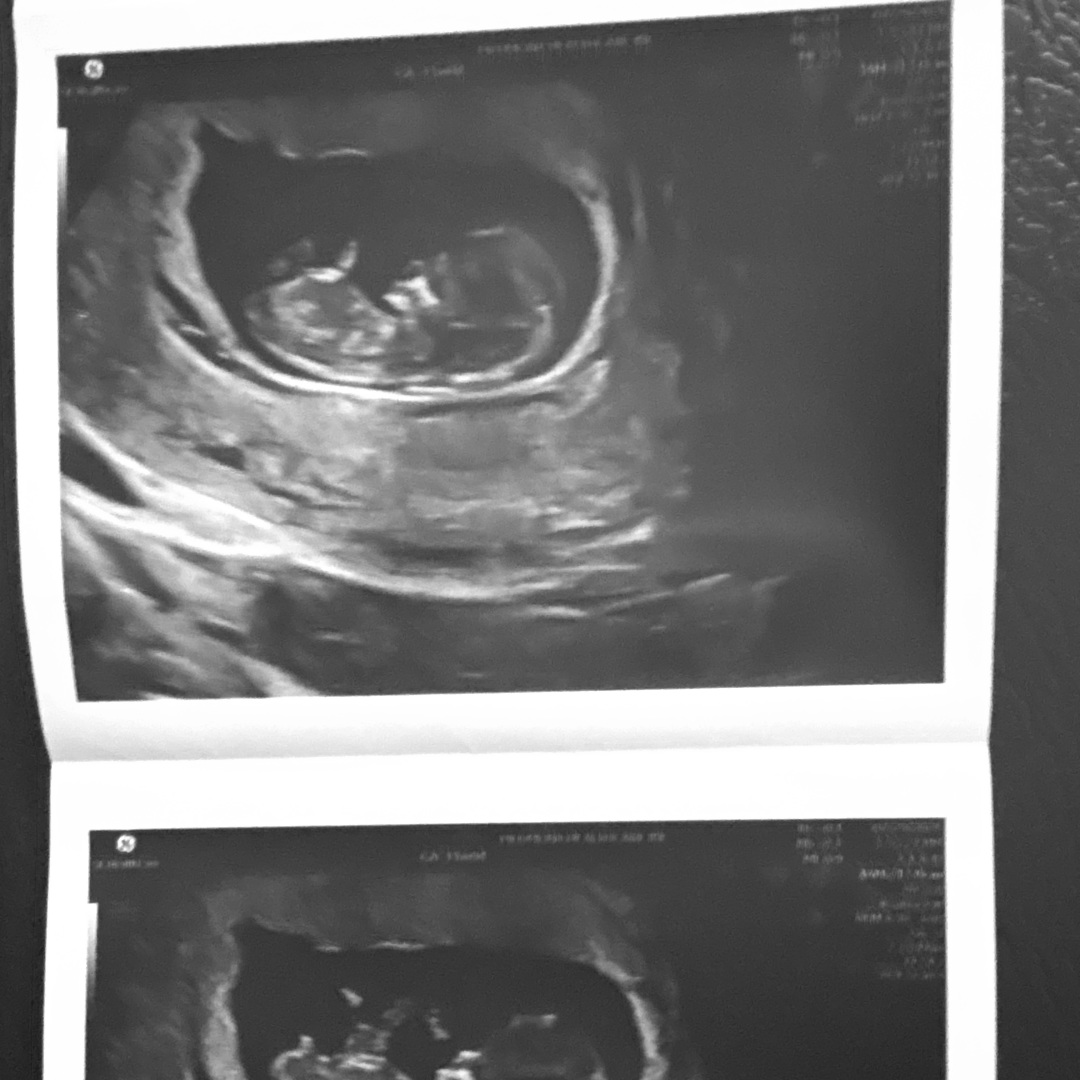 Photo shared by Genevieve for their Babylist baby registry.