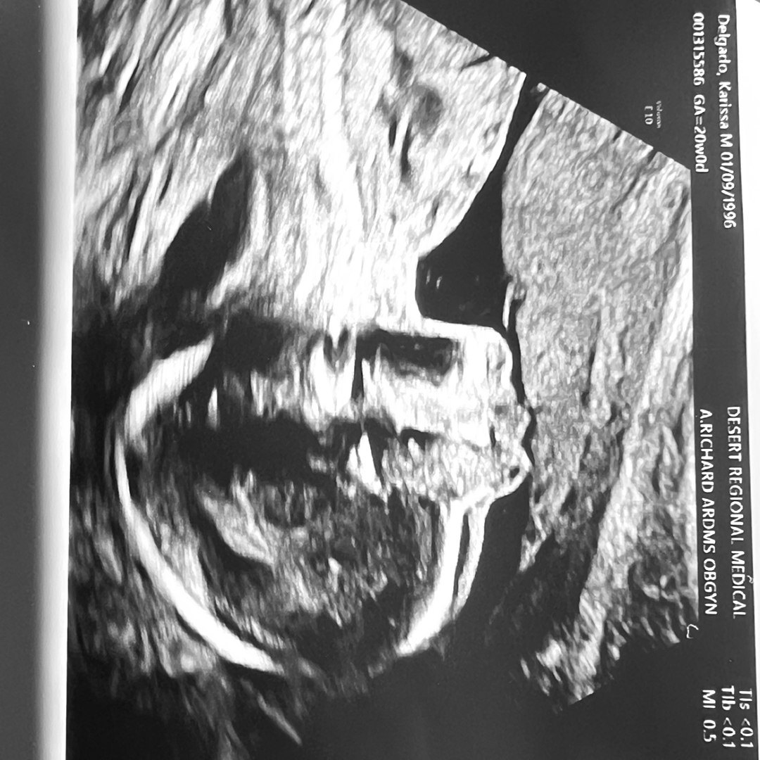 Photo shared by Karissa for their Babylist baby registry.