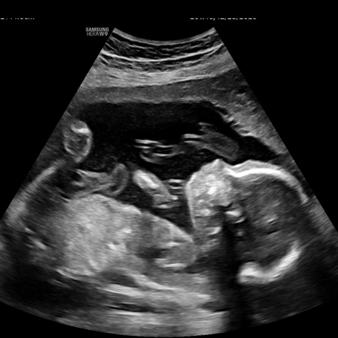 Photo shared by Megan for their Babylist baby registry.