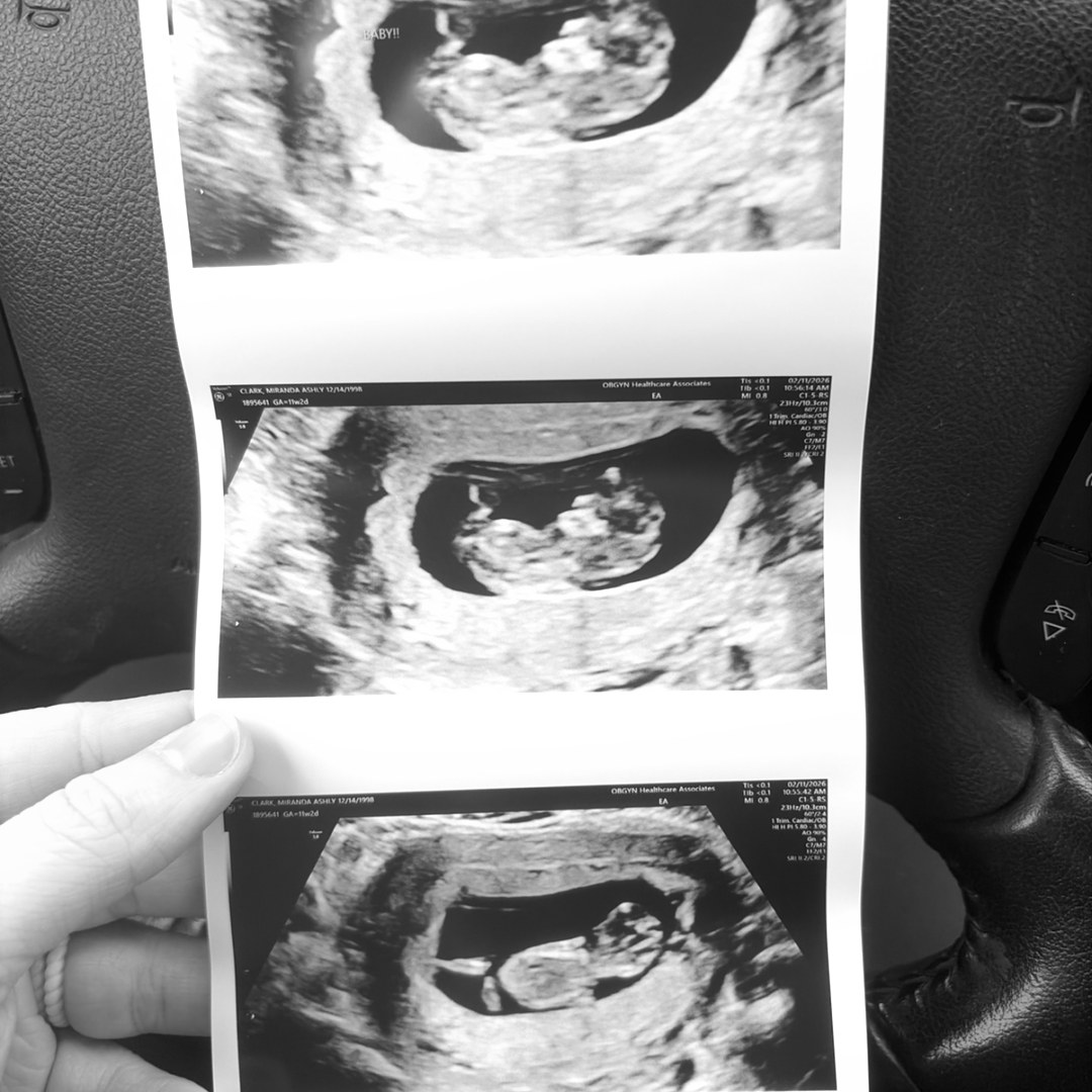 Photo shared by Miranda for their Babylist baby registry.