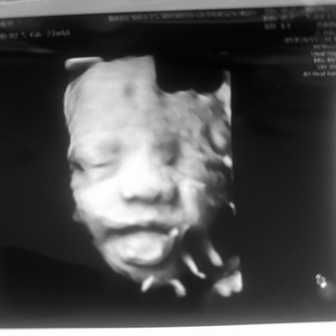 Photo shared by Mandy for their Babylist baby registry.