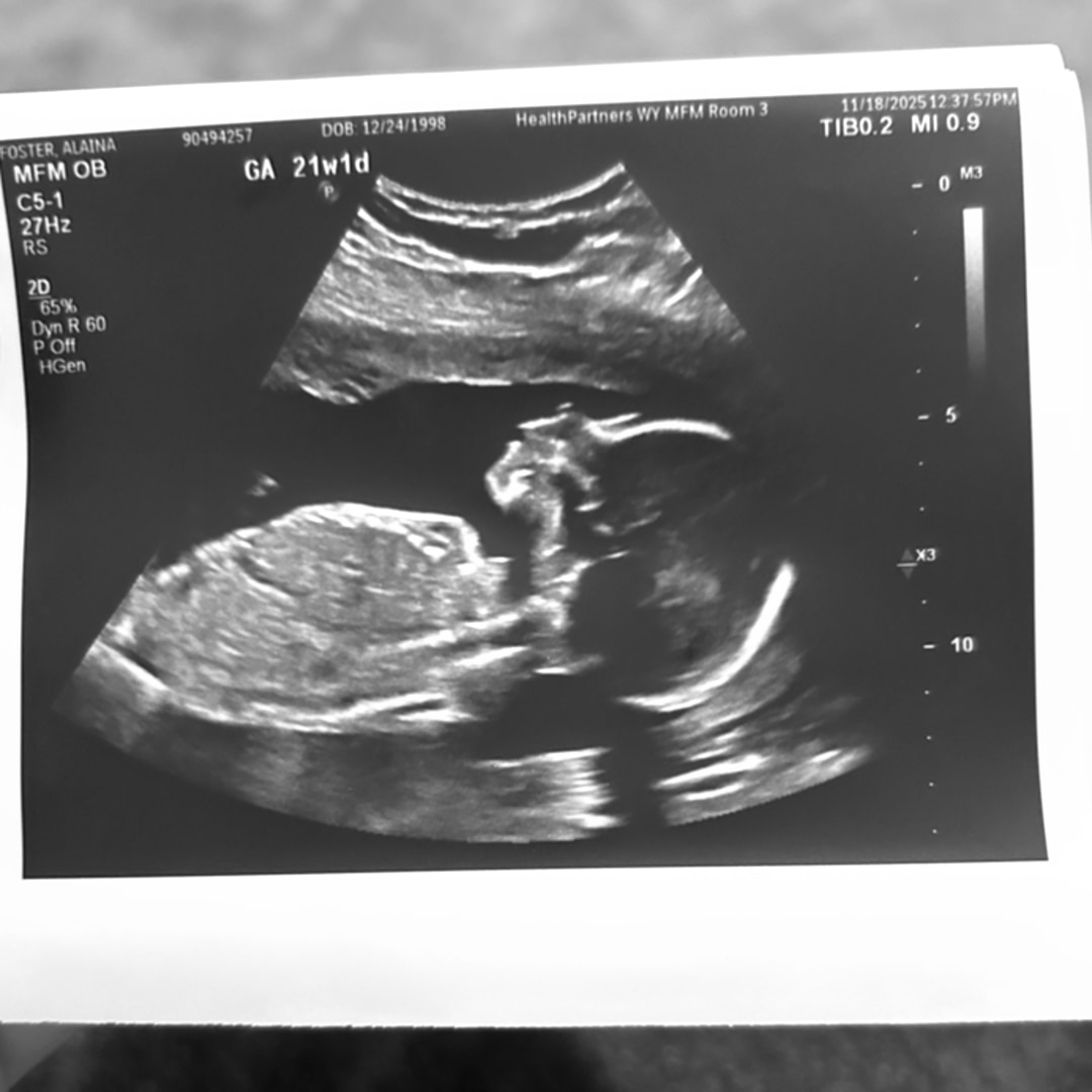 Photo shared by Alaina for their Babylist baby registry.