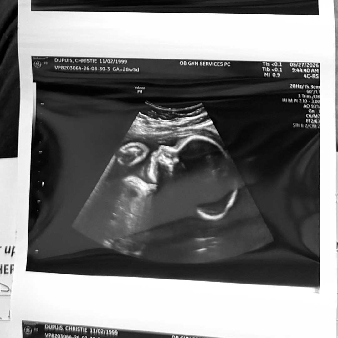 Photo shared by Christie for their Babylist baby registry.