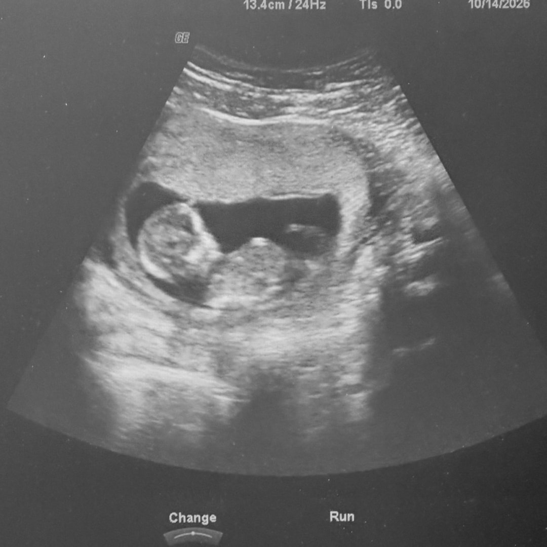 Photo shared by Madyson for their Babylist baby registry.