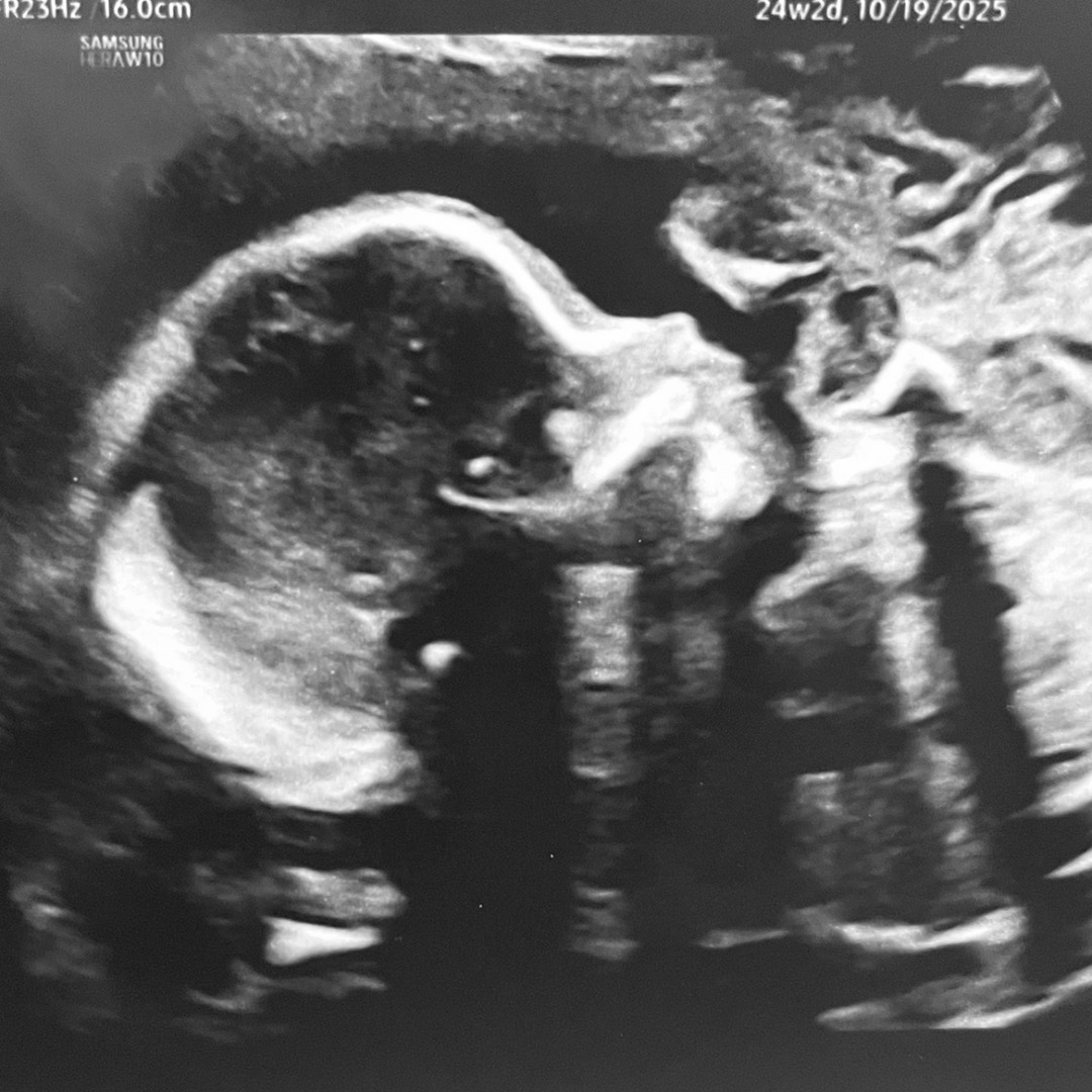 Photo shared by Jessica for their Babylist baby registry.