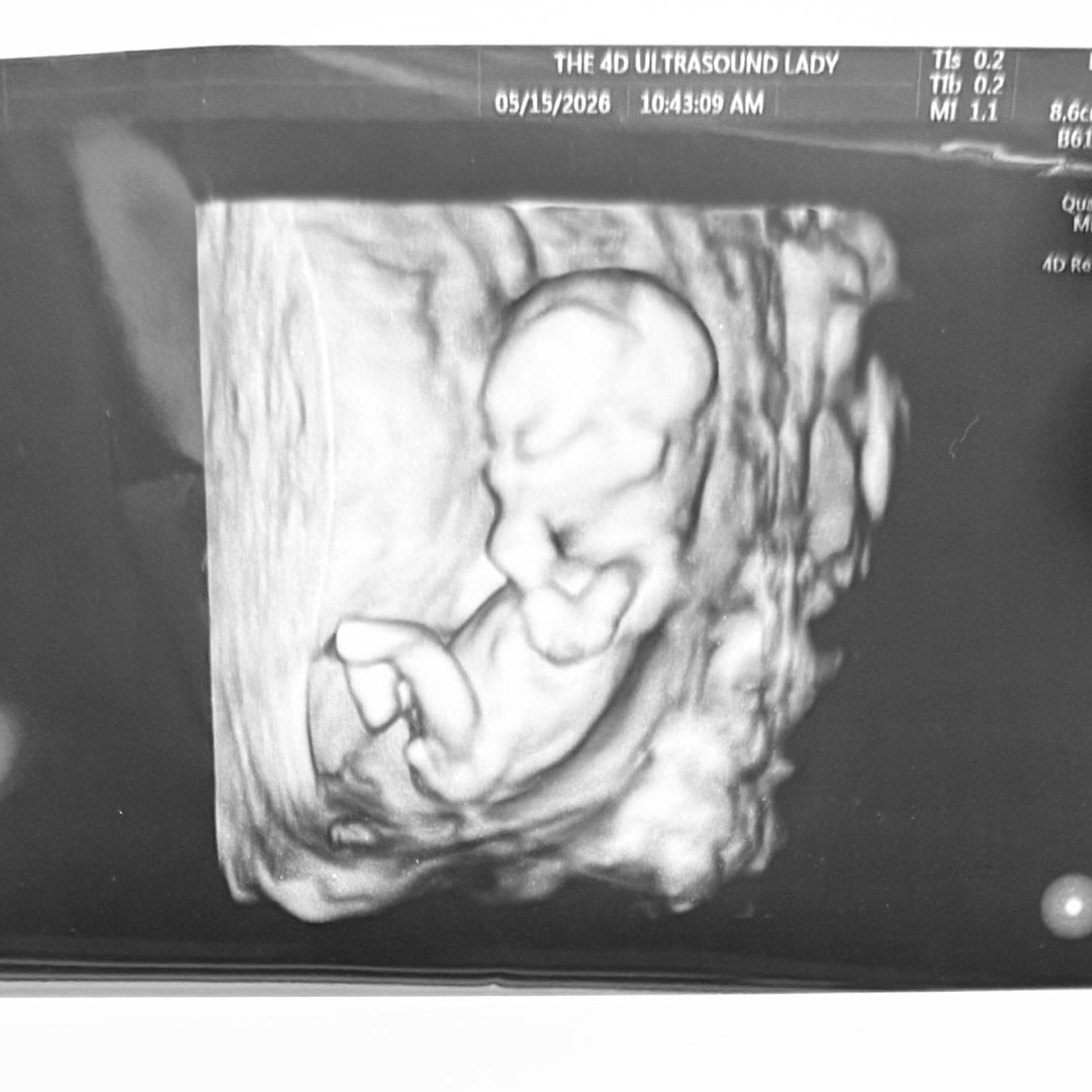 Photo shared by Lilliane for their Babylist baby registry.