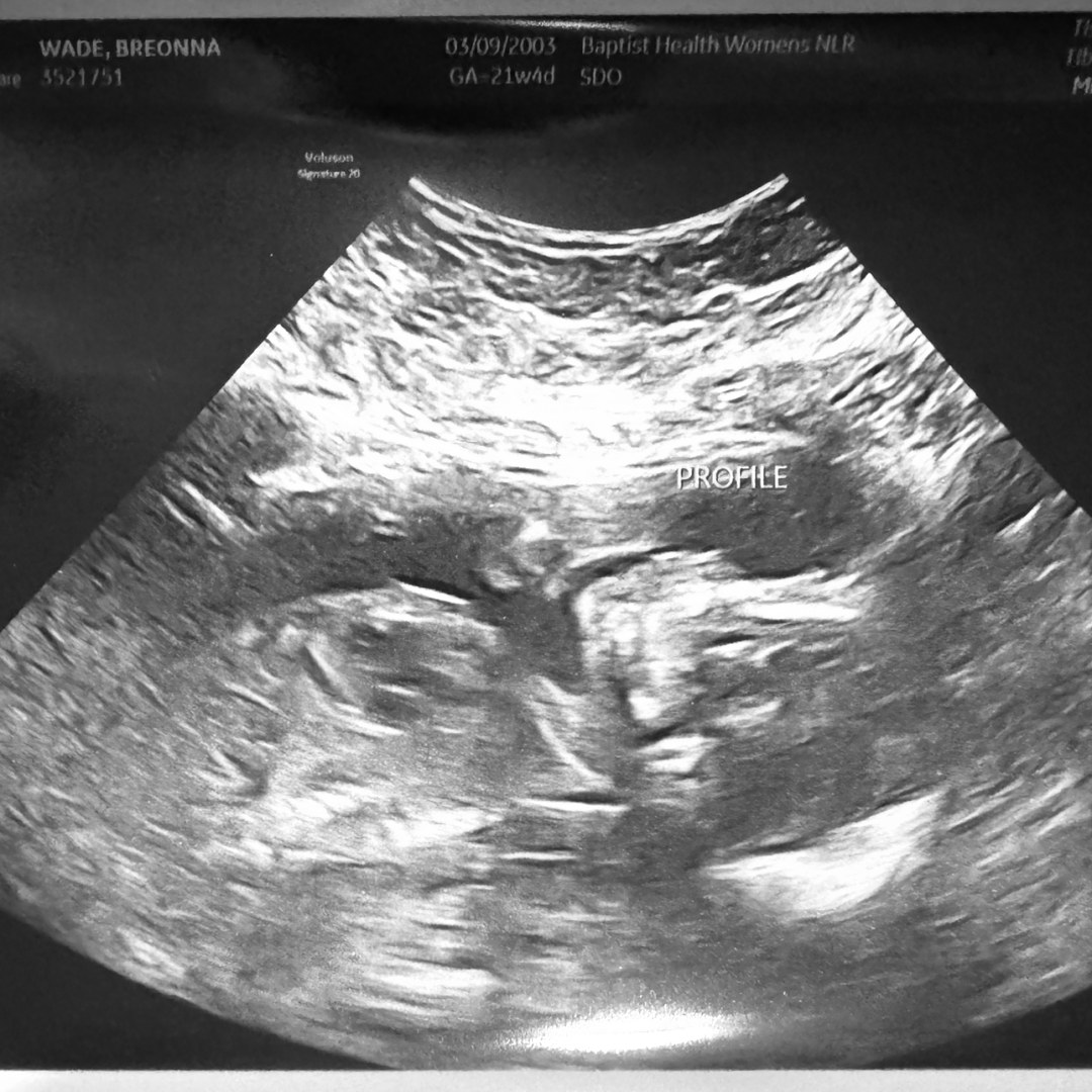 Photo shared by Breonna for their Babylist baby registry.