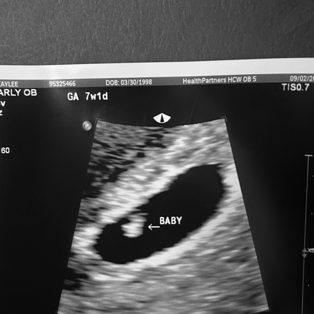 Photo shared by Kaylee for their Babylist baby registry.