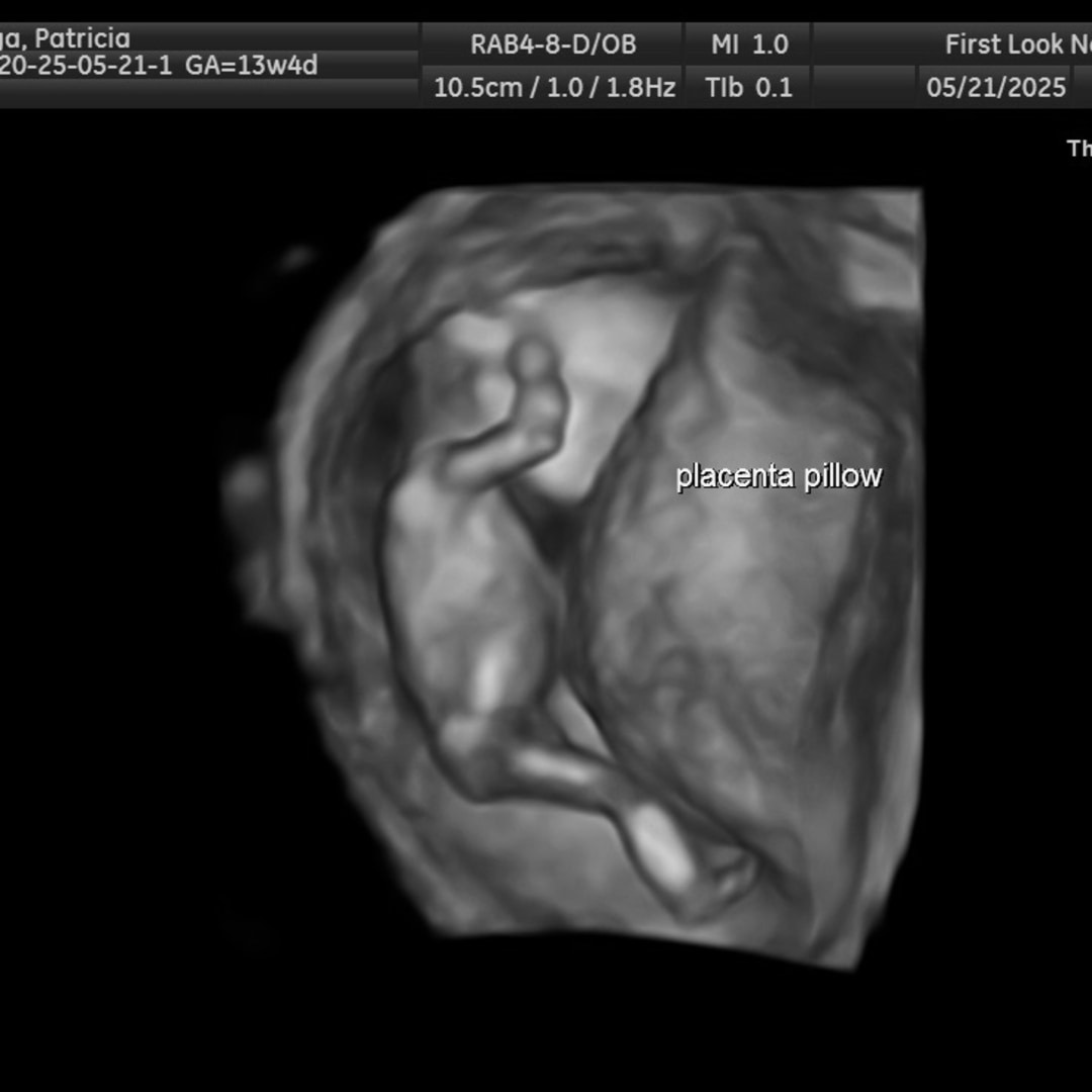 Photo shared by Patricia for their Babylist baby registry.