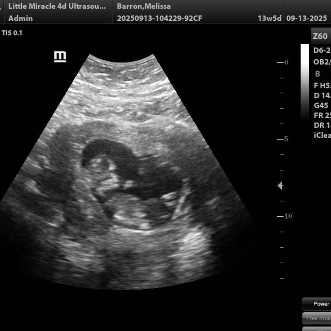 Photo shared by Melissa for their Babylist baby registry.