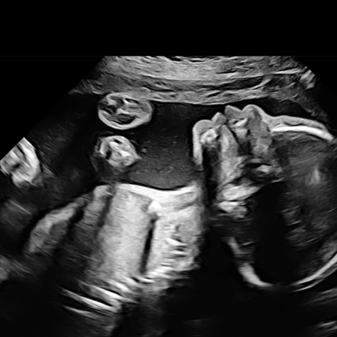 Photo shared by Batouli for their Babylist baby registry.