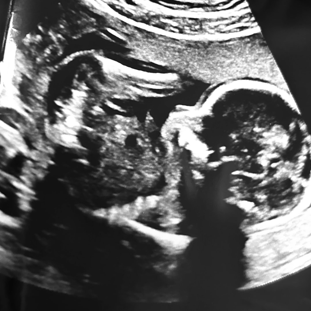 Photo shared by McKenzie for their Babylist baby registry.