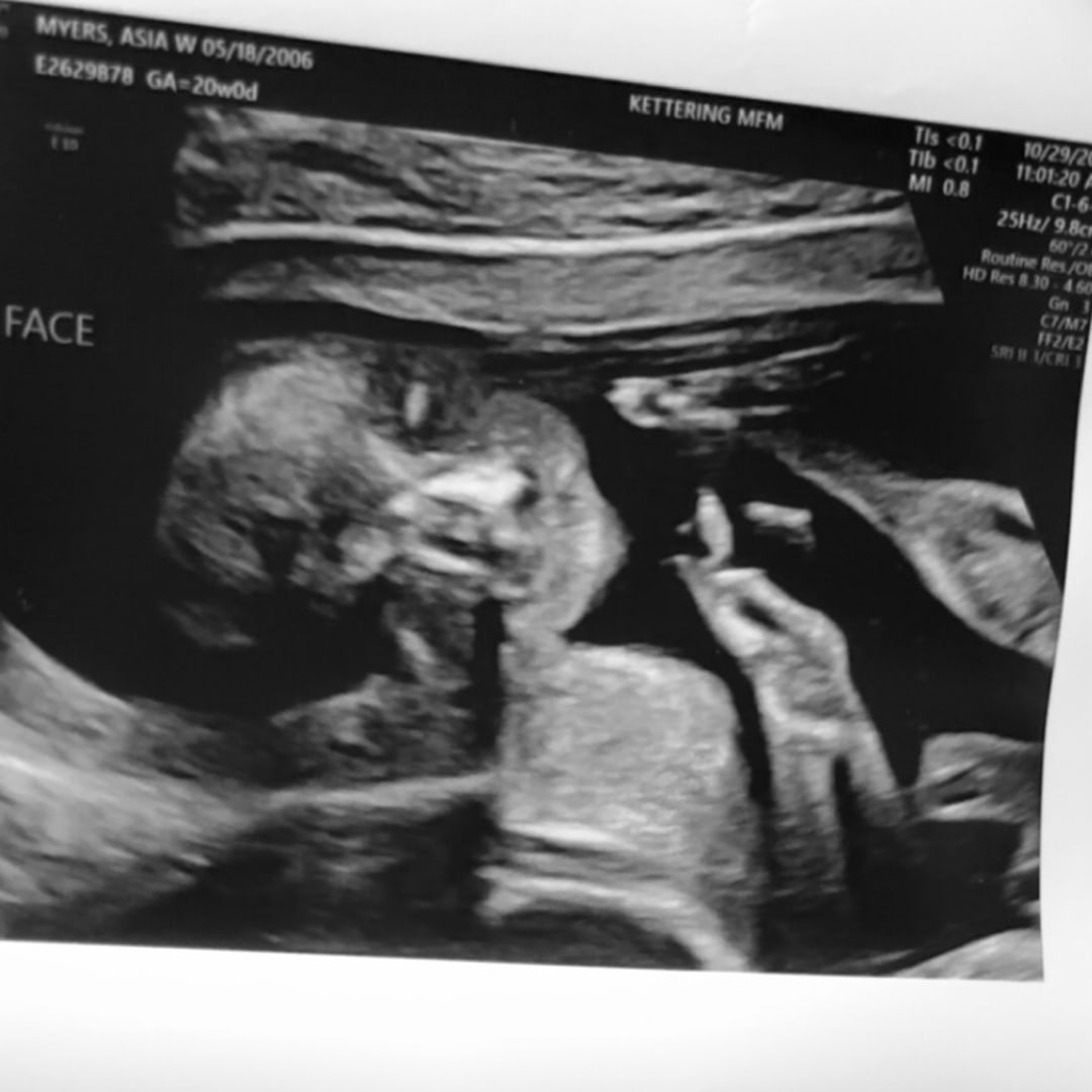 Photo shared by Asia for their Babylist baby registry.