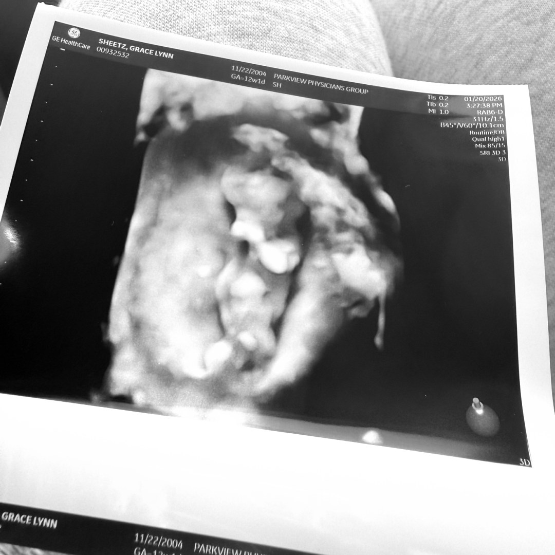 Photo shared by Grace for their Babylist baby registry.