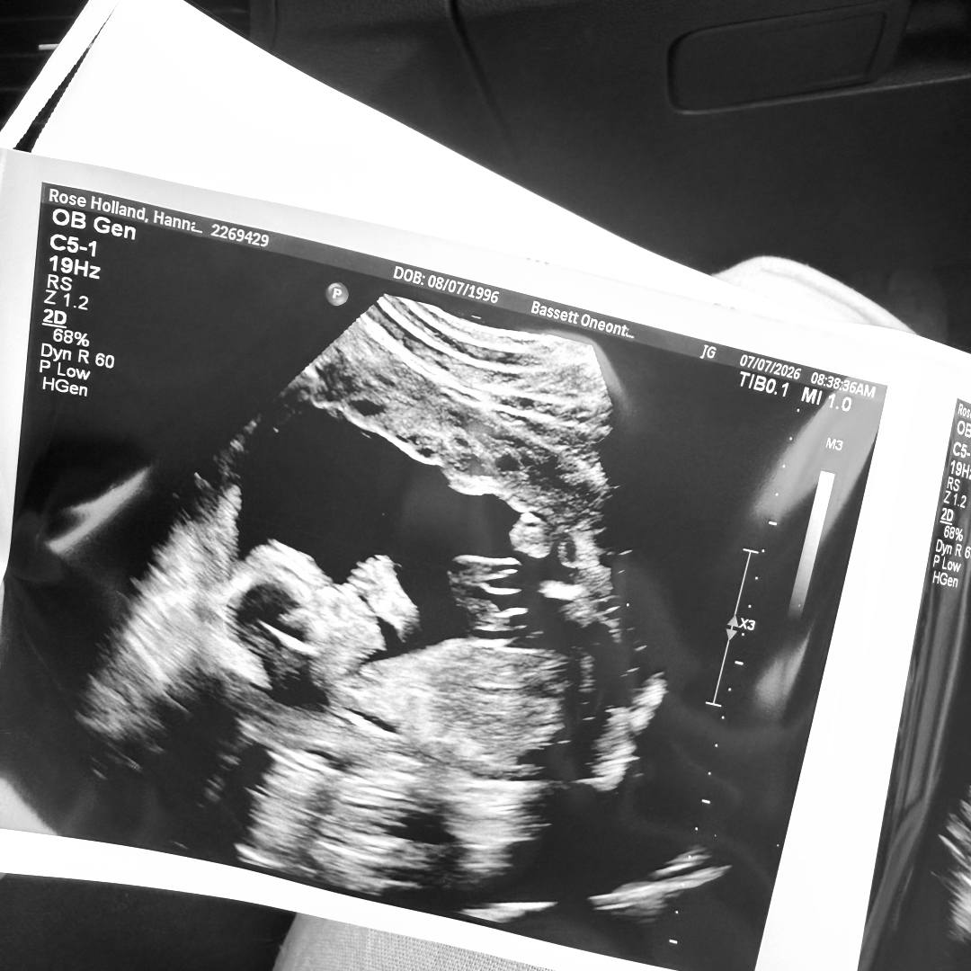 Photo shared by Hannah for their Babylist baby registry.