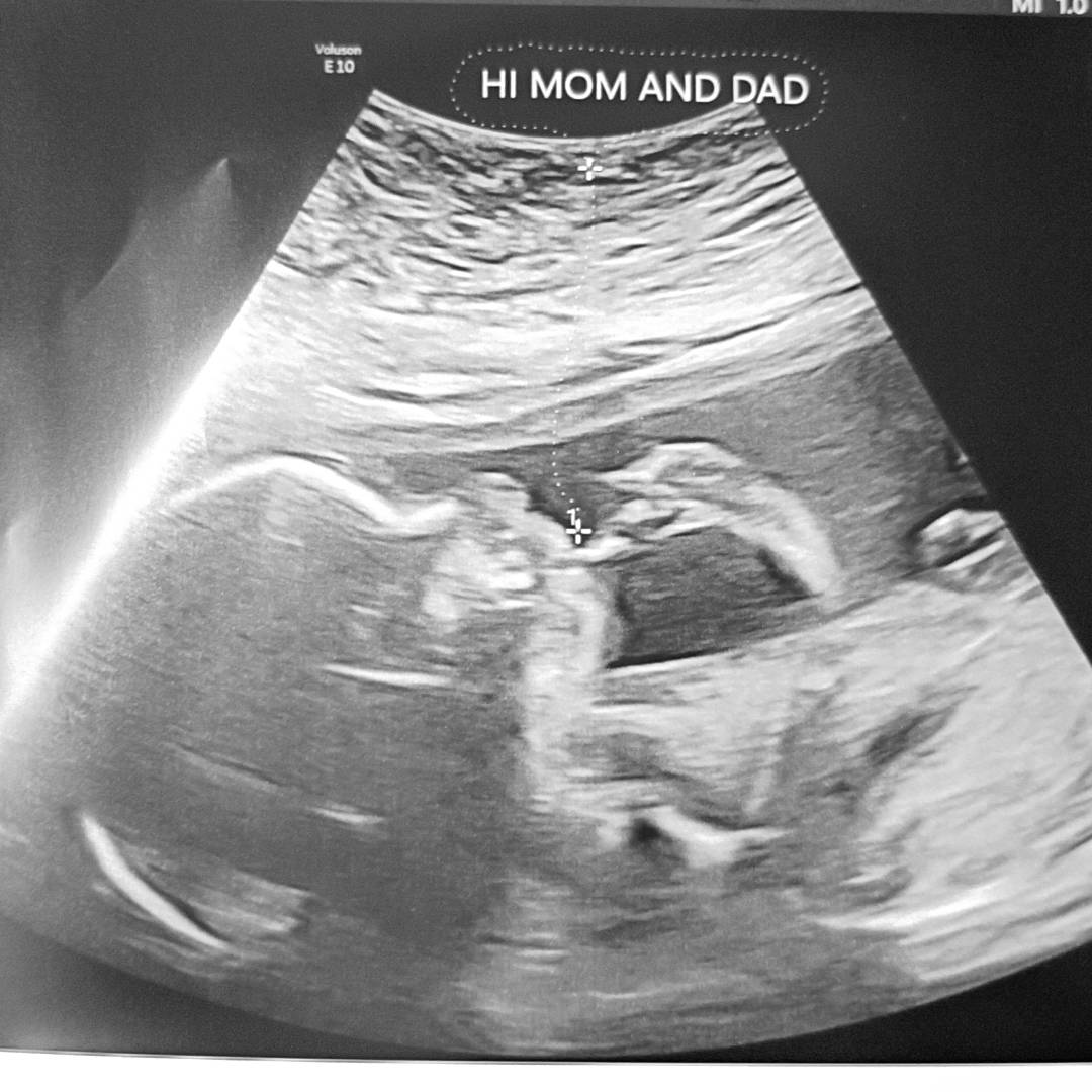 Photo shared by Terri for their Babylist baby registry.