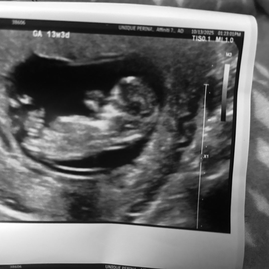 Photo shared by Jaden for their Babylist baby registry.