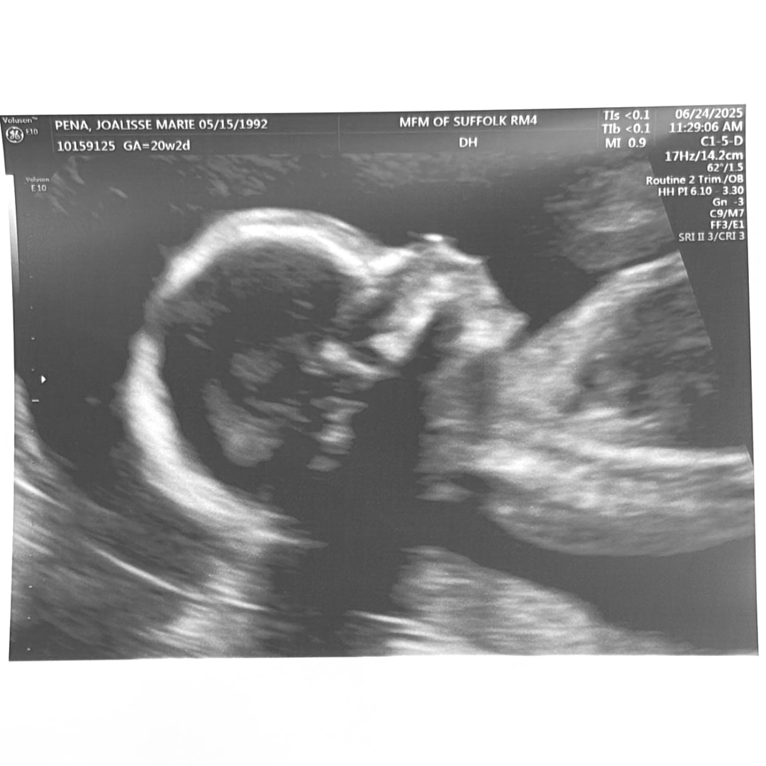 Photo shared by Joalisse for their Babylist baby registry.