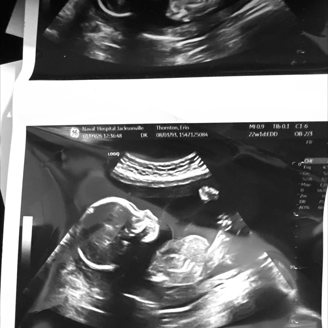 Photo shared by Erin for their Babylist baby registry.