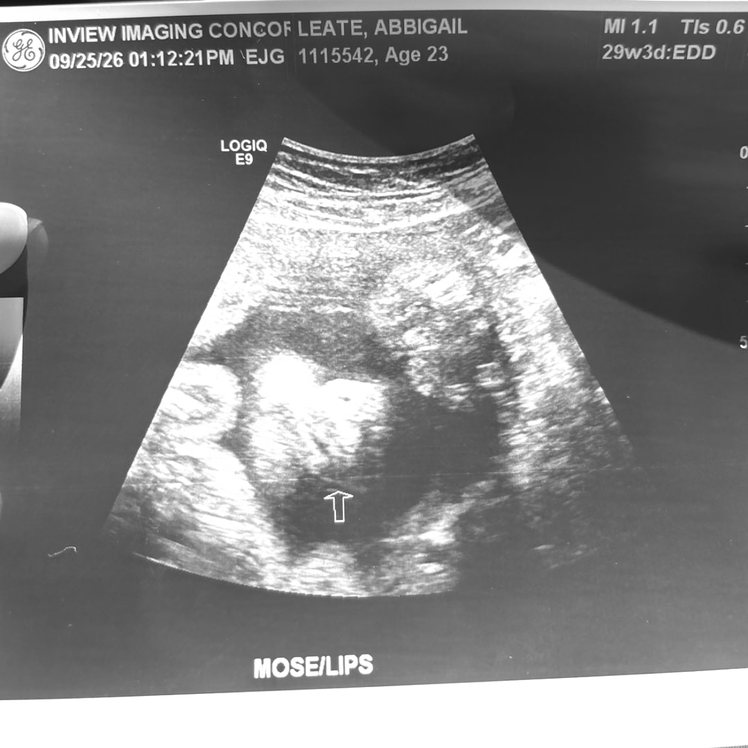 Photo shared by Abbigail for their Babylist baby registry.