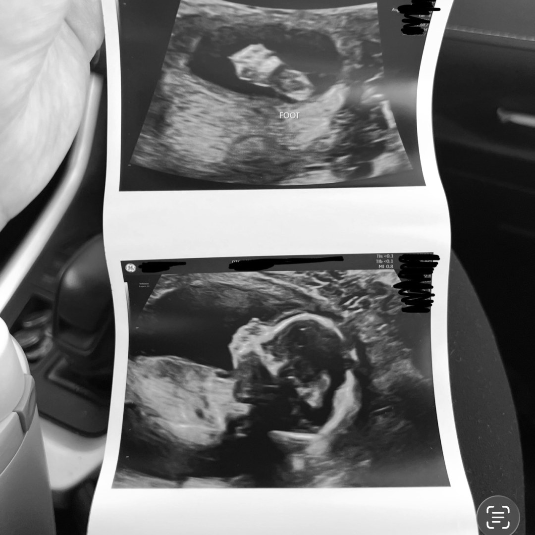 Photo shared by Nadine for their Babylist baby registry.