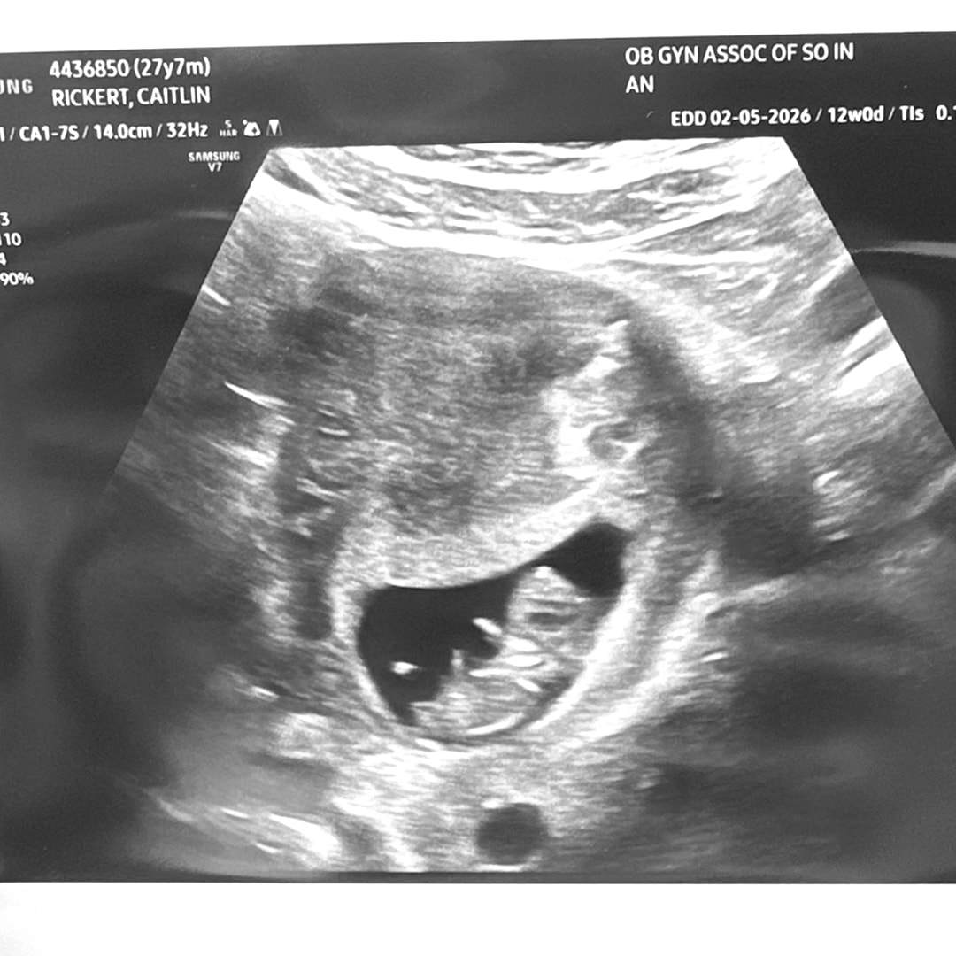 Photo shared by Caitlin for their Babylist baby registry.