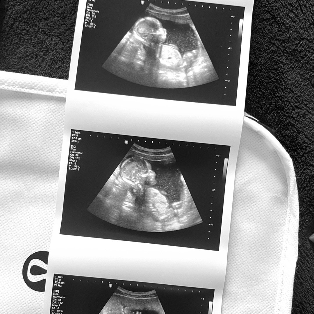 Photo shared by Lynette for their Babylist baby registry.