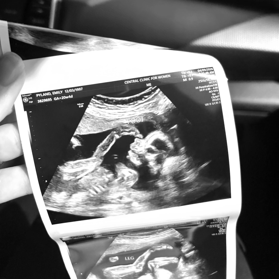 Photo shared by Emily for their Babylist baby registry.
