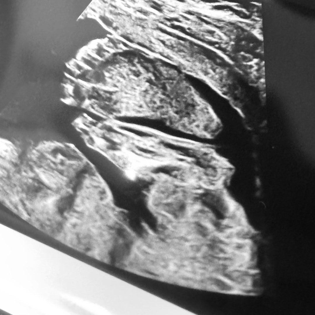 Photo shared by Cassandra for their Babylist baby registry.