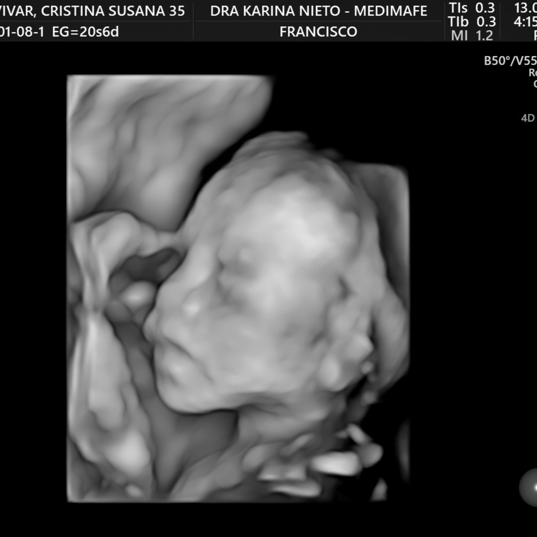 Photo shared by Cris for their Babylist baby registry.