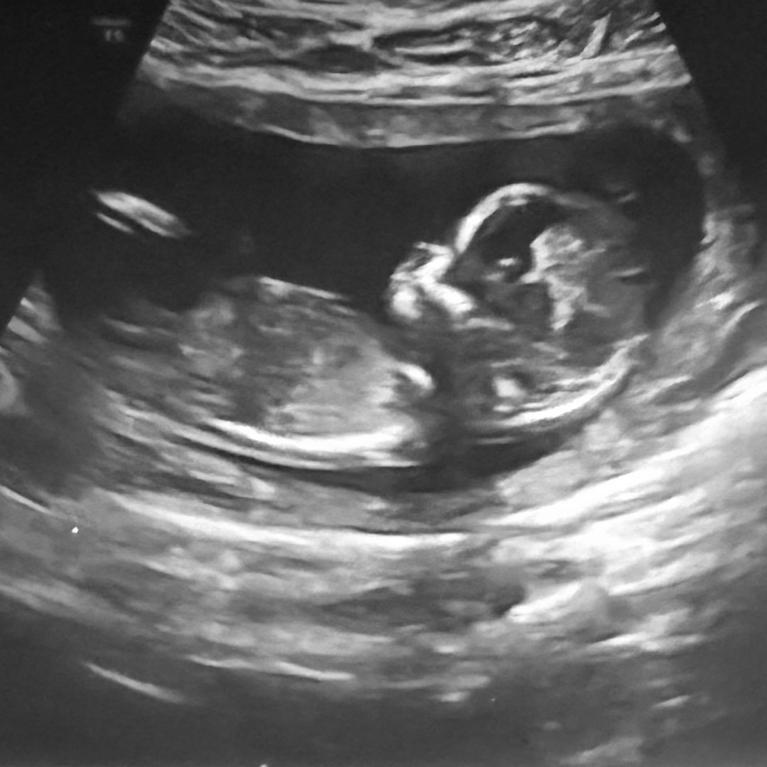 Photo shared by Abbyelie for their Babylist baby registry.