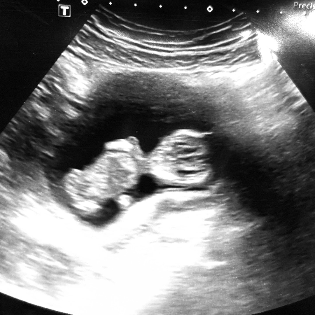 Photo shared by Kaysea for their Babylist baby registry.