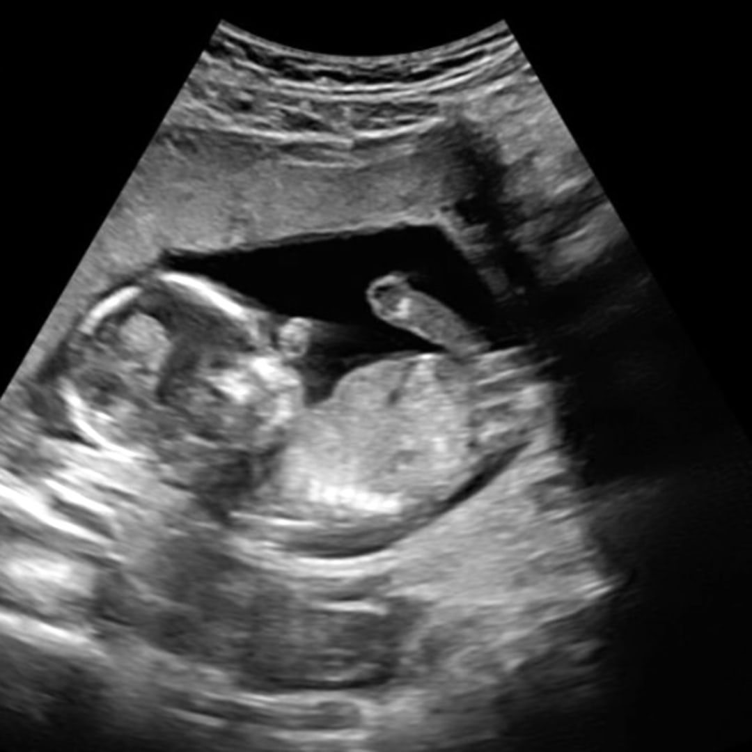 Photo shared by Chacona for their Babylist baby registry.