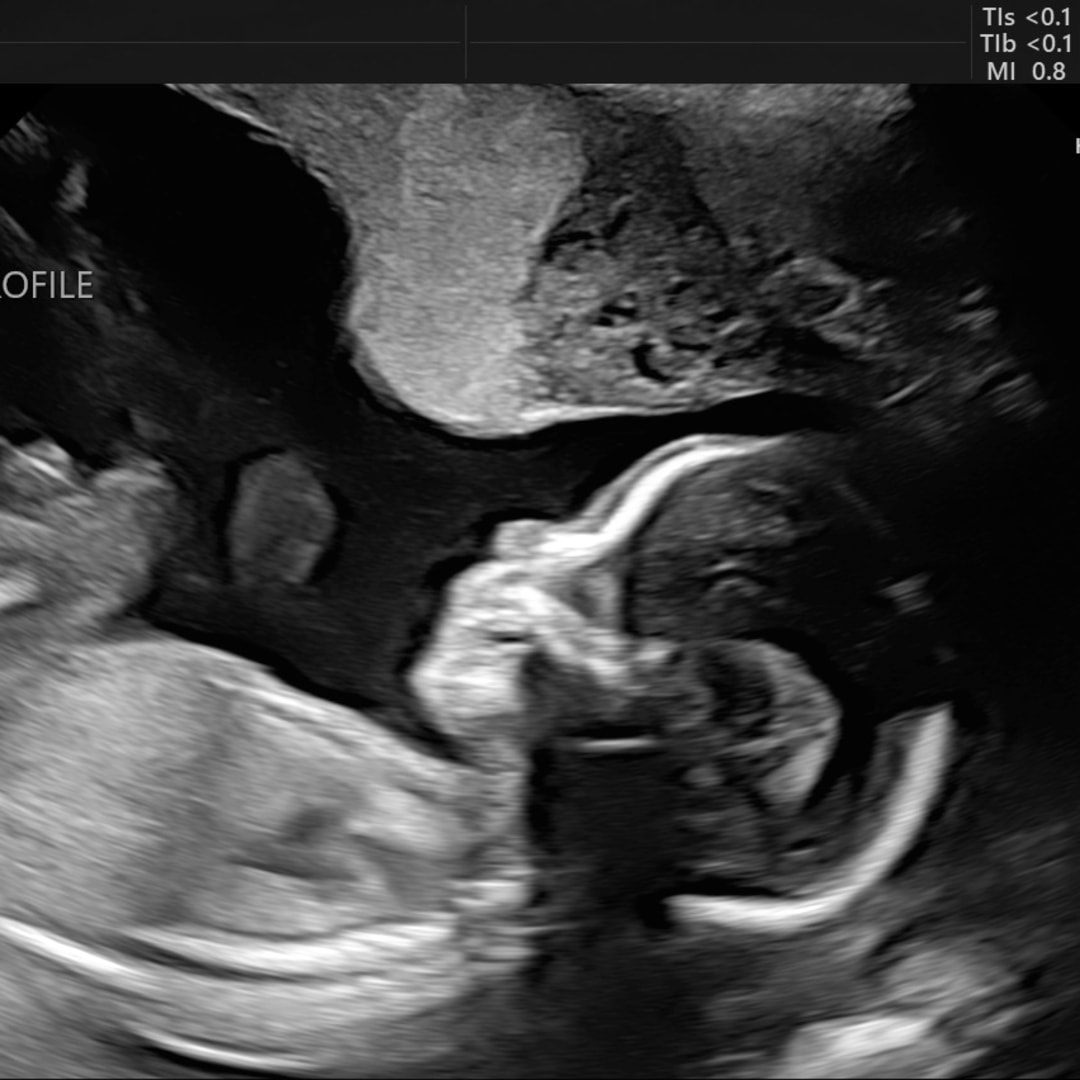 Photo shared by Holly for their Babylist baby registry.