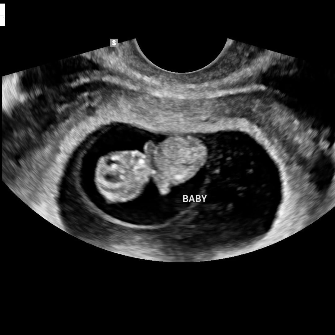 Photo shared by Evie for their Babylist baby registry.