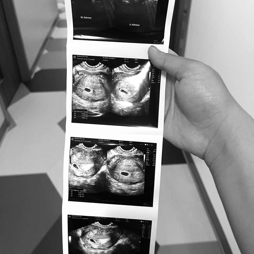 Photo shared by Micaela for their Babylist baby registry.