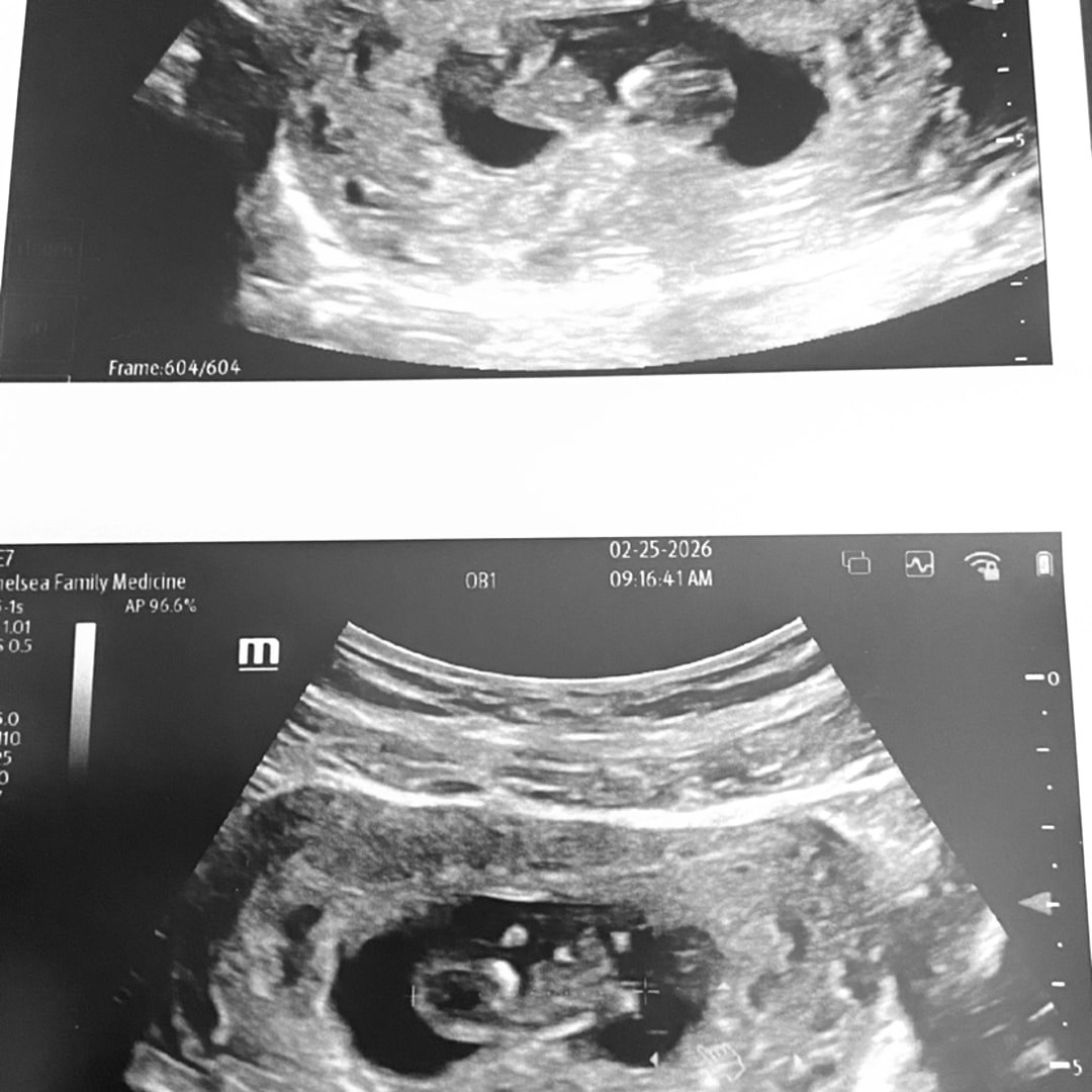 Photo shared by Makayla for their Babylist baby registry.
