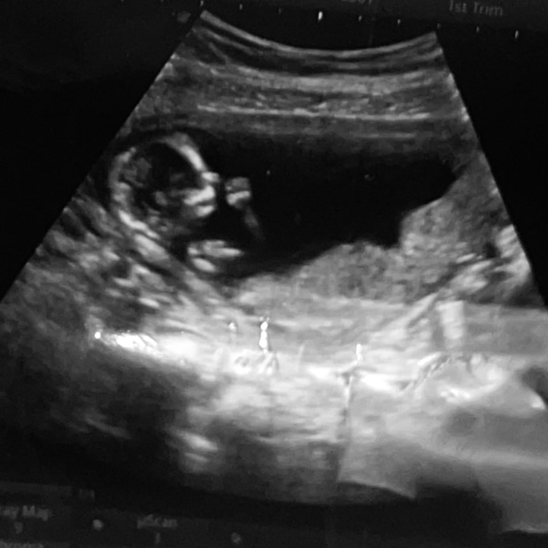 Photo shared by Rosalyn for their Babylist baby registry.